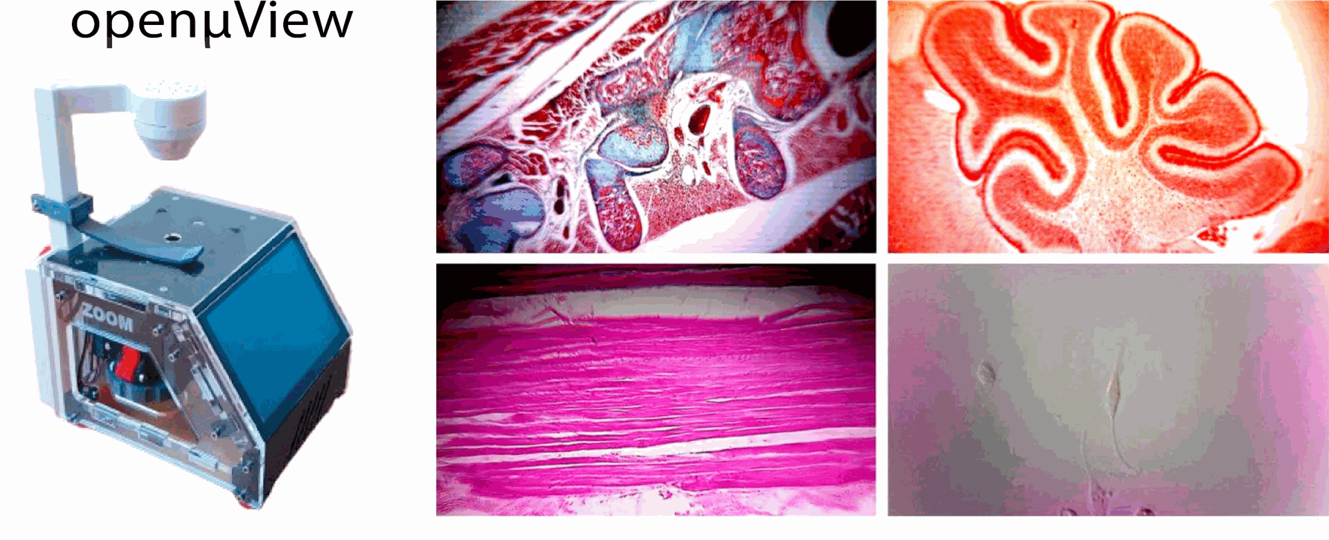 MicroscopeRaspberry PiCameraPortableLow-cost