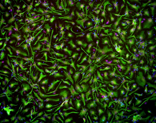 [25sk129] Cortical Astrocytes