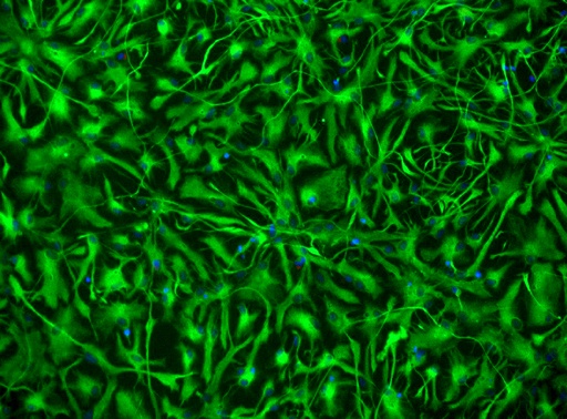 [26sk135] Endothelial Cells