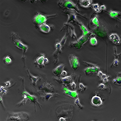[26sk141] Disorder Cells(Microglia)