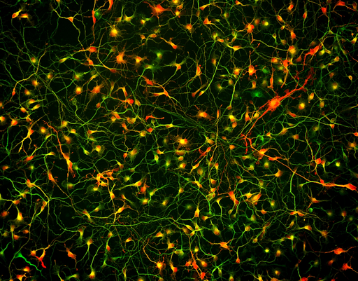 [26sk167] BrainFast Neuronal Maturation Supplement SK
