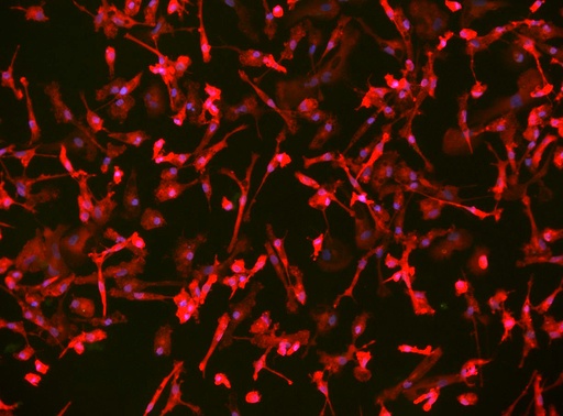 [25sk140] Microglia WC-32