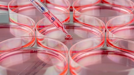 [SK-STEM-175] Human Embryonic Stem Cell H9 (H9 Feeder Free)