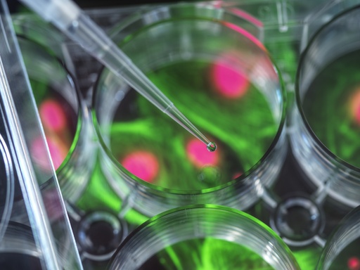 [SA-CAS9-107] Alzheimer’s Disease (AD) Model: Tau Phosphorylation Assay Cell Line