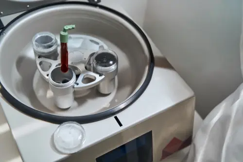 [BS-MFUG-8R] benchtop mini centrifuge with two rotors red lid